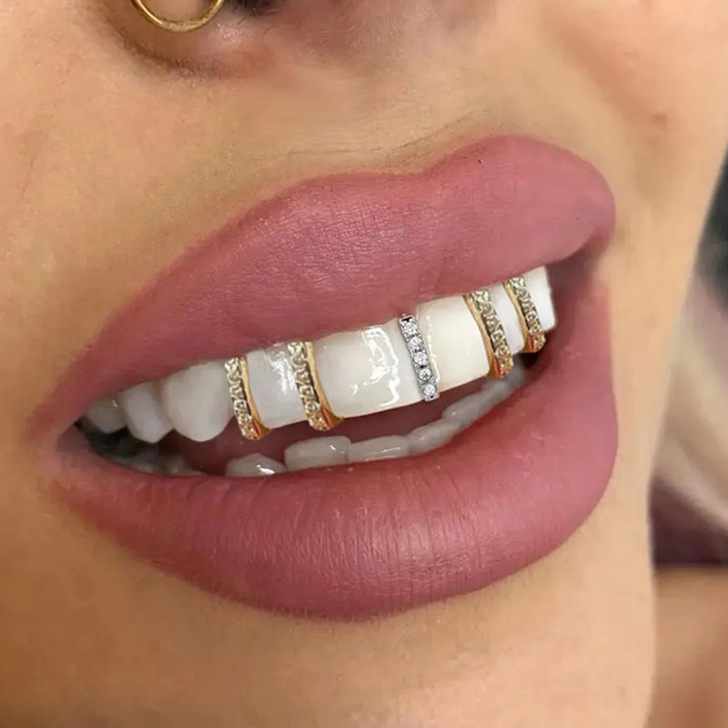 😁Trendy And Cool · Hip-Hop Tooth Jewelry Set✨💎