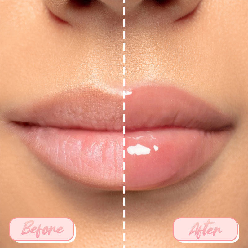 Moisturizing Jelly Lip Balm